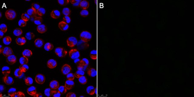 Anti-Influenza A Antibody, nucleoprotein, clone A1 clone A1, Chemicon&#174;, from mouse