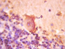 Anti-NeuroD 2 Antibody Chemicon®, from rabbit