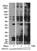 Anti-Acetyl Lysine, Pan, clone RM101 Antibody clone RM101, from rabbit, purified by affinity chromatography