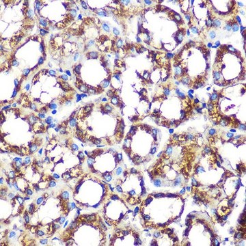 Anti-NOXA2/p67phox antibody produced in rabbit