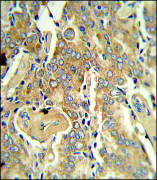 ANTI-VEGFC antibody produced in rabbit IgG fraction of antiserum, buffered aqueous solution