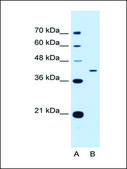 Anti-APOH antibody produced in rabbit affinity isolated antibody
