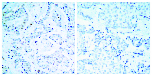 Anti-Estrogen Receptor-&#945; antibody produced in rabbit affinity isolated antibody