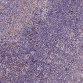Anti-CASKIN2 Prestige Antibodies® Powered by Atlas Antibodies, affinity isolated antibody