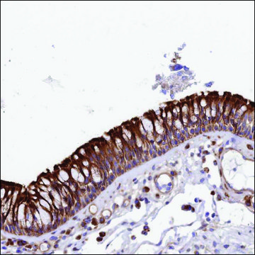 Anti-VPS13C antibody produced in rabbit Prestige Antibodies&#174; Powered by Atlas Antibodies, affinity isolated antibody, buffered aqueous glycerol solution