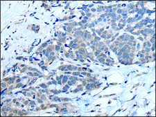 Anti-MTHFR affinity isolated antibody