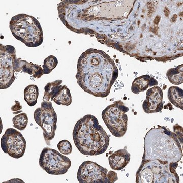 Anti-WHAMM antibody produced in rabbit Prestige Antibodies&#174; Powered by Atlas Antibodies, affinity isolated antibody, buffered aqueous glycerol solution