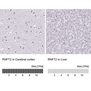 Anti-RNFT2 antibody produced in rabbit Prestige Antibodies&#174; Powered by Atlas Antibodies, affinity isolated antibody, buffered aqueous glycerol solution