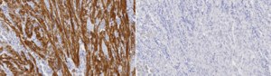 Anti-MLCK Antibody, clone 5K6 ZooMAb® Rabbit Monoclonal recombinant, expressed in HEK 293 cells