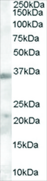 Anti-TIM3/HAVCR2 antibody produced in goat affinity isolated antibody, buffered aqueous solution