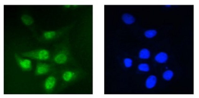 Anti-PP2A reg. subunit B56 epsilon (PPP2R5E) Antibody, clone 5A5-1F3 clone 5A5-1F3, from mouse