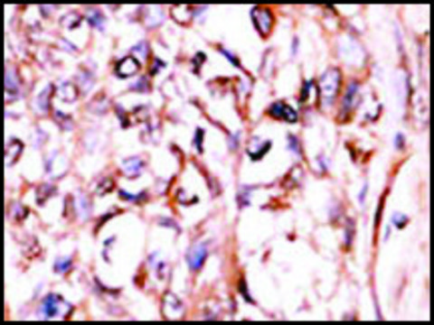 Anti-PPM1E (C-term) antibody produced in rabbit IgG fraction of antiserum, buffered aqueous solution