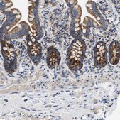 Anti-TOMM6 antibody produced in rabbit Prestige Antibodies® Powered by Atlas Antibodies, affinity isolated antibody, buffered aqueous glycerol solution