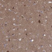 Anti-ATP6V1G2 antibody produced in rabbit Prestige Antibodies® Powered by Atlas Antibodies, affinity isolated antibody, buffered aqueous glycerol solution