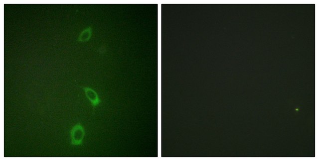 Anti-ROMK antibody produced in rabbit affinity isolated antibody