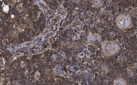 Anti-CTGF Antibody, clone 1O16 ZooMAb® Rabbit Monoclonal recombinant, expressed in HEK 293 cells