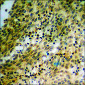Anti-phospho-TK (pSer13) antibody produced in rabbit affinity isolated antibody