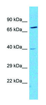 Anti-NPY2R (N-terminal) antibody produced in rabbit affinity isolated antibody