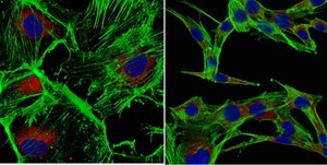 Anti-S100A4 Antibody, clone 9D5.1 clone 9D5.1, from mouse