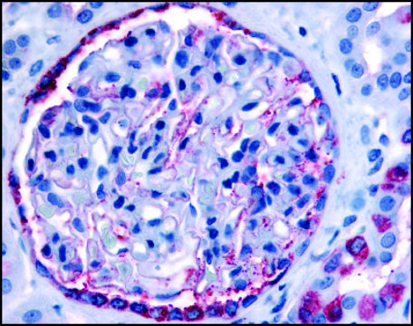 Anti-PIB5PA (AB1) antibody produced in rabbit affinity isolated antibody, buffered aqueous solution