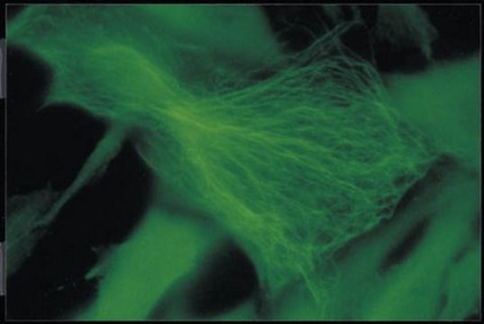 Anti-Ankyrin Antibody, clone Ank016 clone Ank016, Chemicon&#174;, from mouse