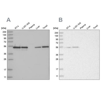 Anti-RBM17 antibody produced in rabbit Prestige Antibodies&#174; Powered by Atlas Antibodies, affinity isolated antibody, buffered aqueous glycerol solution