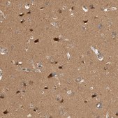 Anti-OTUD6B antibody produced in rabbit Prestige Antibodies® Powered by Atlas Antibodies, affinity isolated antibody, buffered aqueous glycerol solution, Ab2