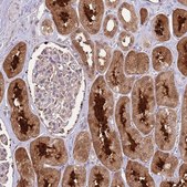 Anti-SALL1 antibody produced in rabbit Prestige Antibodies® Powered by Atlas Antibodies, affinity isolated antibody, buffered aqueous glycerol solution