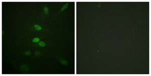 Anti-CDC25B antibody produced in rabbit affinity isolated antibody