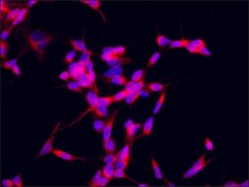 Anti-ZNF746 antibody produced in rabbit ~1.0 mg/mL, affinity isolated antibody