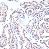 Anti-NKX2-1 Antibody, clone 3O2N3, Rabbit Monoclonal