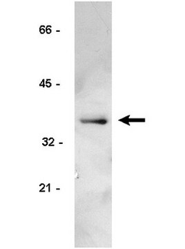 Anti-Cyclin D1/2 Antibody, clone 5D4 clone 5D4, Upstate&#174;, from mouse