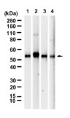 Anti-PLVAP Antibody, clone 3K18 ZooMAb® Rabbit Monoclonal recombinant, expressed in HEK 293 cells