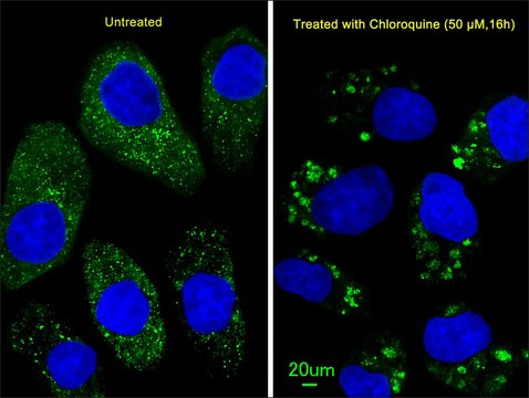 ANTI-LC3 (APG8B) (N-TERM) antibody produced in rabbit purified immunoglobulin, buffered aqueous solution