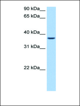 Anti-ALKBH8 antibody produced in rabbit affinity isolated antibody