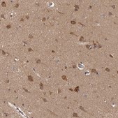 Anti-HBS1L antibody produced in rabbit Prestige Antibodies® Powered by Atlas Antibodies, affinity isolated antibody, buffered aqueous glycerol solution, ab2