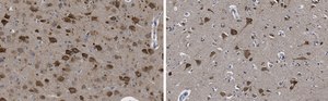 Anti-LC3B Antibody, clone 12K5, ZooMAb® Rabbit Monoclonal recombinant, expressed in HEK 293 cells