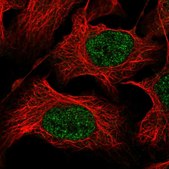 Anti-ZSCAN9 antibody produced in rabbit Prestige Antibodies® Powered by Atlas Antibodies, affinity isolated antibody, buffered aqueous glycerol solution