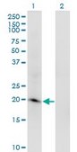 Monoclonal Anti-ARL2BP antibody produced in mouse clone 2G6, purified immunoglobulin, buffered aqueous solution