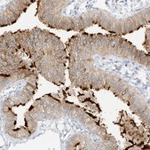 Anti-DCDC2 antibody produced in rabbit Prestige Antibodies® Powered by Atlas Antibodies, affinity isolated antibody, buffered aqueous glycerol solution