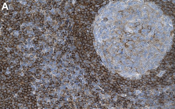 Ani-APPL1 Antibody, clone 2K17 ZooMAb&#174; Rabbit Monoclonal recombinant, expressed in HEK 293 cells