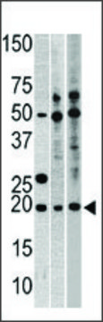 Anti-DHX15 (C-term) antibody produced in rabbit IgG fraction of antiserum, buffered aqueous solution