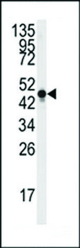 ANTI-NSE (Y236) antibody produced in rabbit affinity isolated antibody, buffered aqueous solution