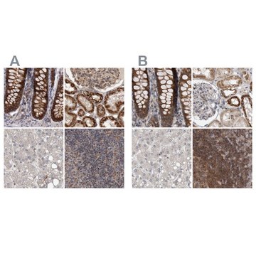 Anti-DARS2 antibody produced in rabbit Prestige Antibodies&#174; Powered by Atlas Antibodies, affinity isolated antibody, buffered aqueous glycerol solution, Ab1