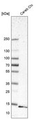Anti-GABARAPL2 antibody produced in rabbit Prestige Antibodies® Powered by Atlas Antibodies, affinity isolated antibody, buffered aqueous glycerol solution