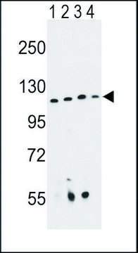 ANTI-RPGRIP1 (CENTER) antibody produced in rabbit IgG fraction of antiserum, buffered aqueous solution