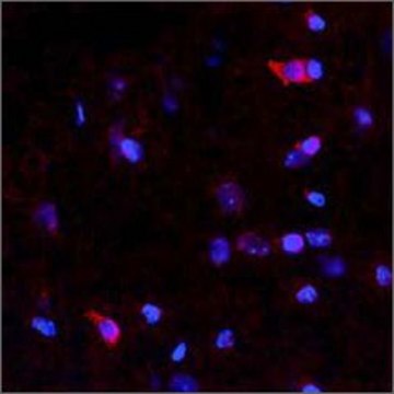 Anti-NTN4 antibody produced in rabbit affinity isolated antibody, lyophilized powder