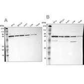 Anti-CKAP4 antibody produced in rabbit Ab1, Prestige Antibodies® Powered by Atlas Antibodies, affinity isolated antibody, buffered aqueous glycerol solution