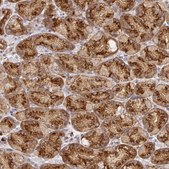 Anti-USO1 antibody produced in rabbit Prestige Antibodies® Powered by Atlas Antibodies, affinity isolated antibody, buffered aqueous glycerol solution