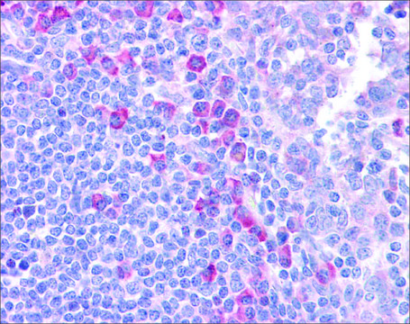 Anti-DLL1 antibody produced in rabbit affinity isolated antibody